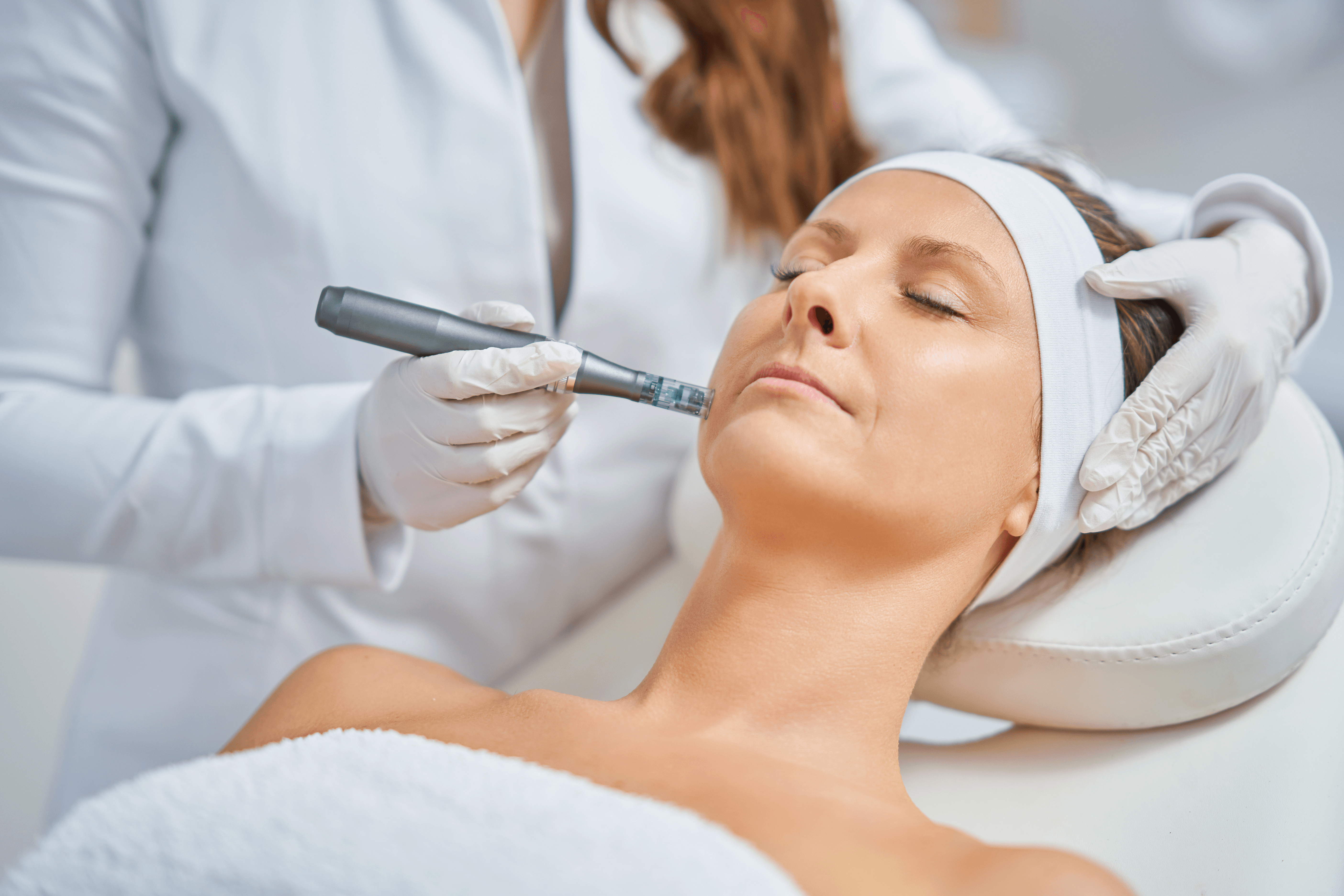 Tratamiento facial dermapen